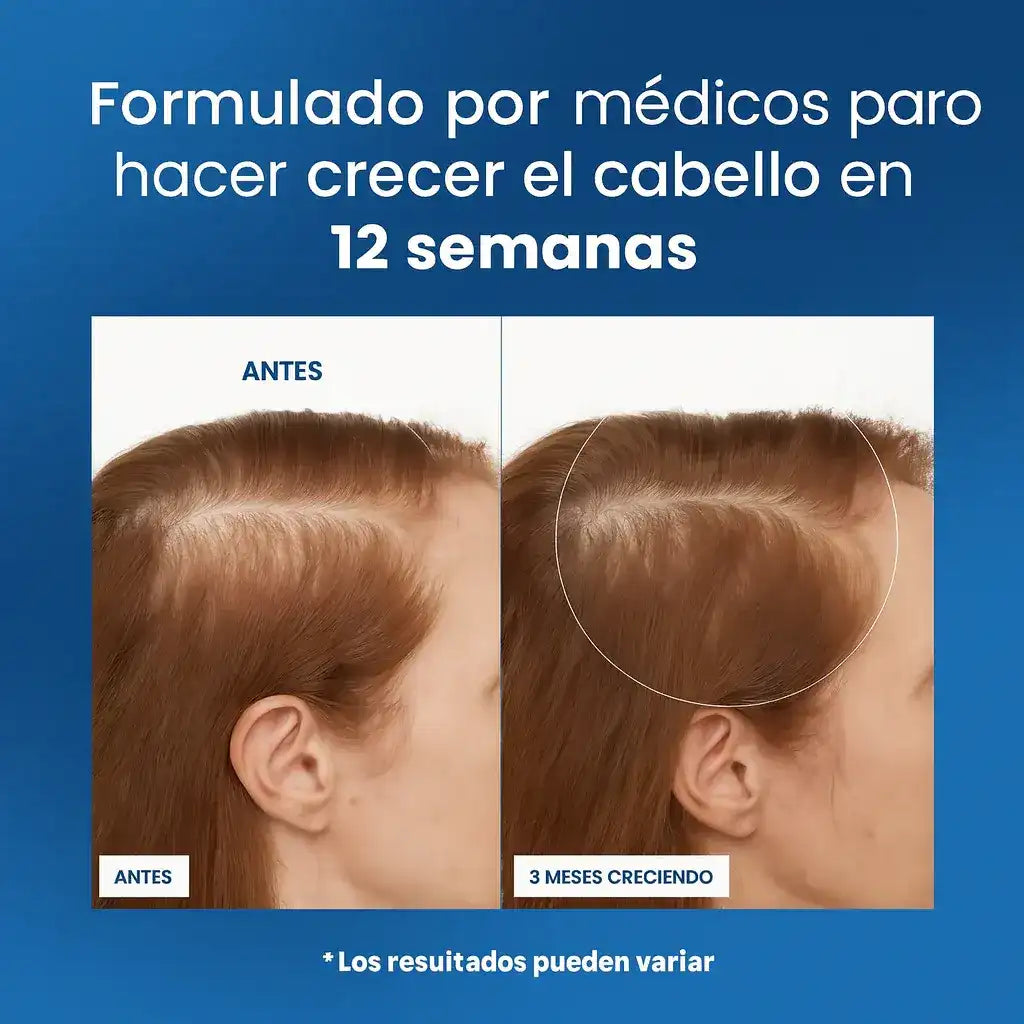 Serum Capilar Roll-On | Crecimiento, Fortalecimiento y Densidad del Cabello